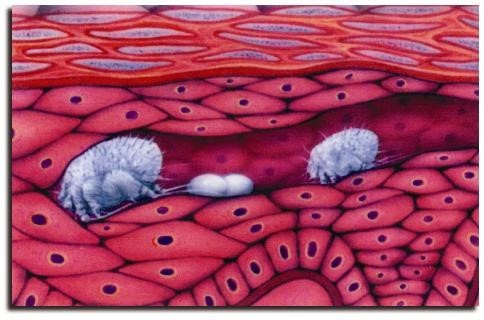 猪疥螨病的诊断和防控方案